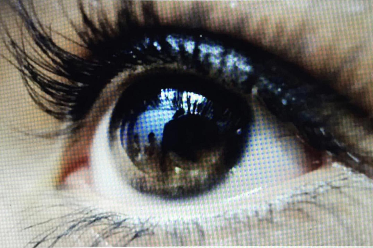 Eye